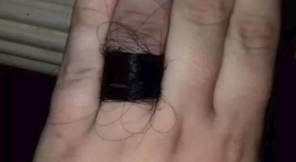 Momak napravio prsten od kose - Avaz