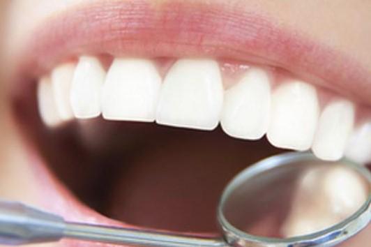 Bojite se stomatologa: Evo kako da se riješite kamenca i naslaga na zubima jednostavno i brzo kod kuće
