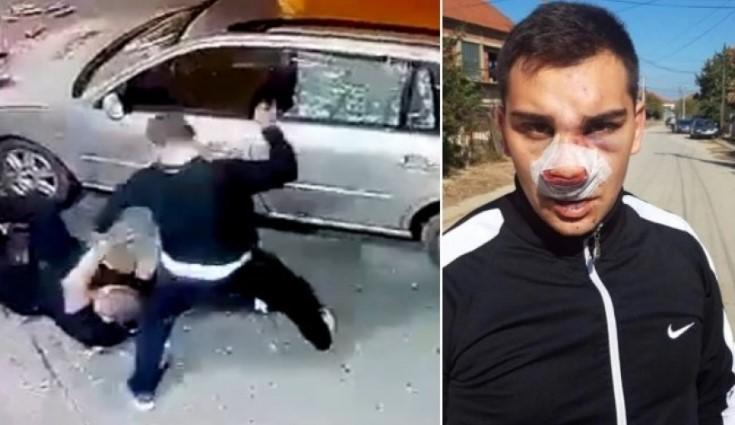 Procurio snimak brutalne tuče u Vranju: Otac vozilom udario napadača pa ga sa sinom pretukao drvenim palicama