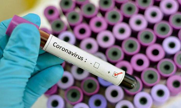 Više 1,5 miliona ljudi umrlo od koronavirusa
