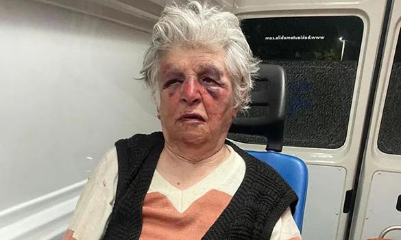 Starica brutalno pretučena u svojoj kući u Kosovskoj Mitrovici