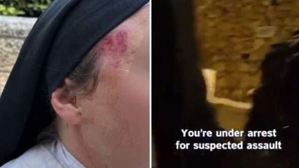 Brutalan napad na svetom mjestu: Muškarac srušio francusku časnu sestru pa ju cipelario