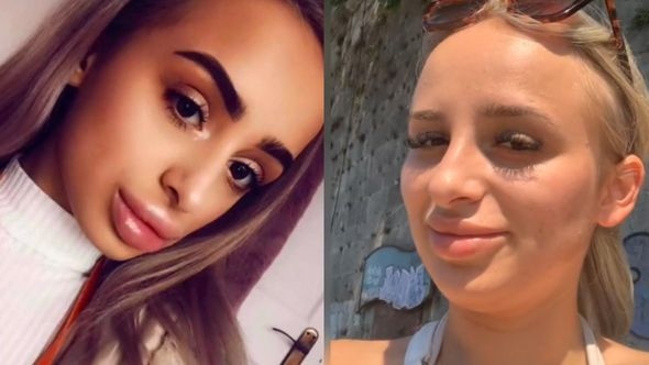 Dvije godine je bila ovisna o filerima za usne: ''Unakazila sam se, stalno su me vrijeđali''