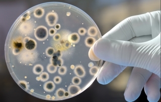 Šta znači pozitivan IgG nalaz na Parvovirus B19 