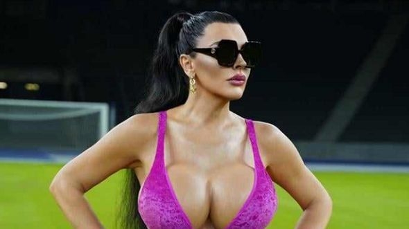 “Balkan broji 35. 000 prostitutki”: Elektra Elite progovorila o prostituciji na javnoj sceni