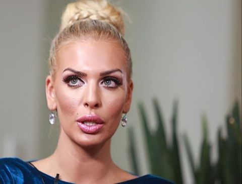 Ava Karabatić nakon što je pretukao partner objavila uznemirujuću fotografiju: Bojim se za svoj život
