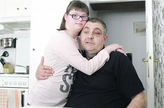 Dvojica muškaraca isprebijala oca djevojčice s Downovim sindromom