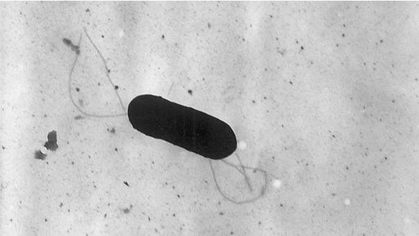 Vibrio bakterija - Avaz