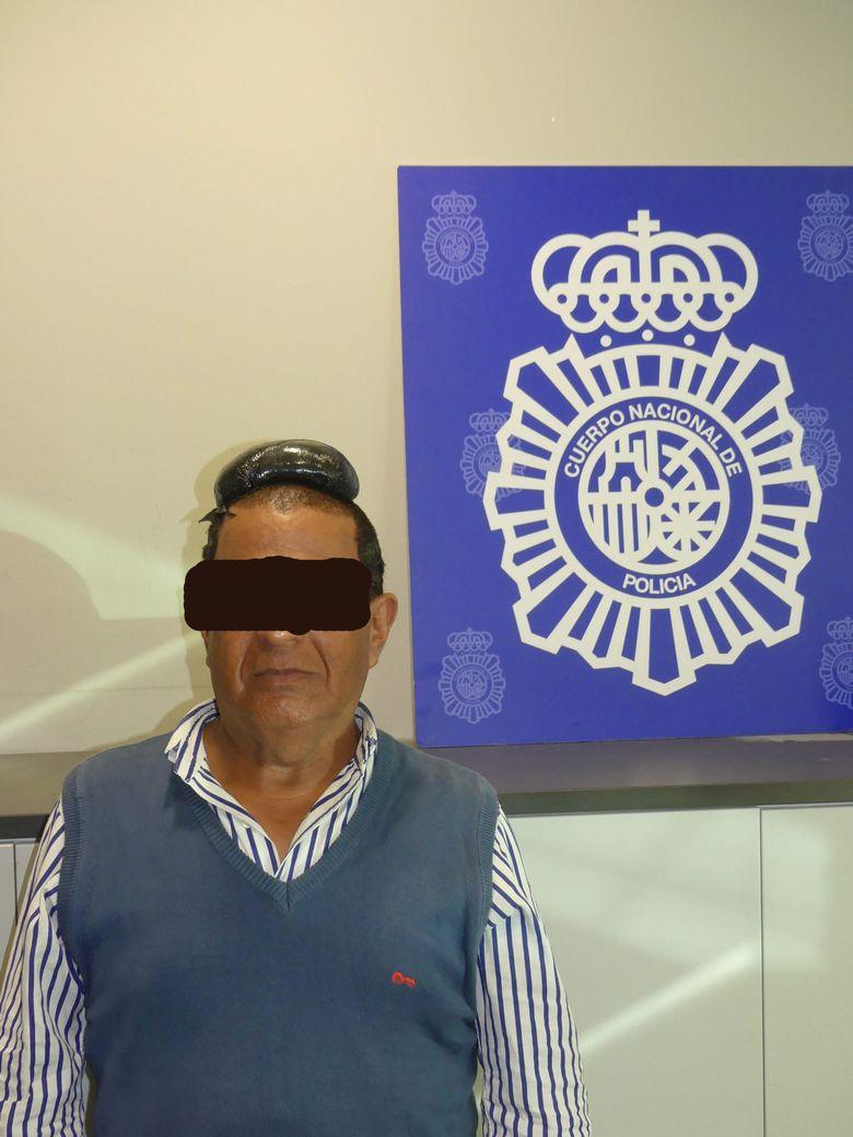 Pogledajte urnebesnog krijumčara droge: Kolumbijac ispod tupea krio paket s kokainom