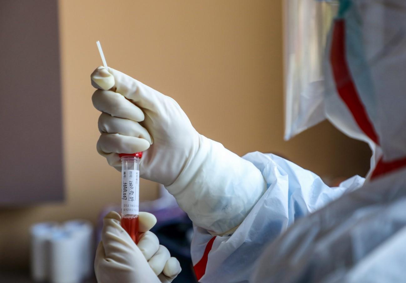 Na području Federacije 17 ljudi pod zdravstvenim nadzorom zbog zabrinutosti od koronavirusa