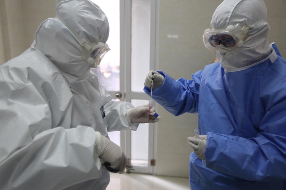 U Crnoj Gori se pod zdravstveno-sanitarnim nadzorom zbog koronavirusa nalaze 382 osobe - Avaz