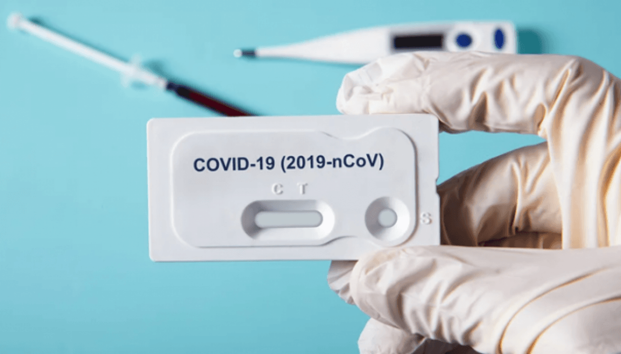 Američka trgovačka komora pomogla nabavku 150.000 testova za koronavirus