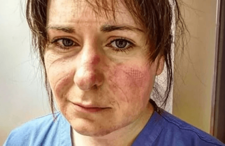 Potresna fotografija medicinske sestre: "Kad poželite izaći, sjetite se ovog lica"