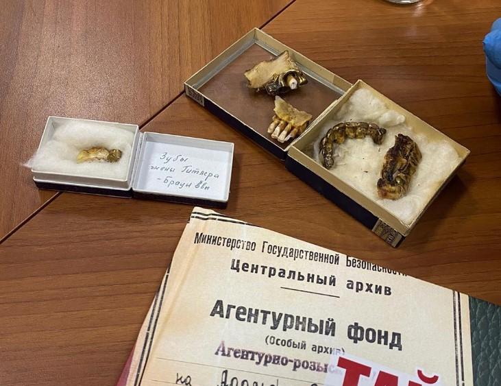 Objavljene nevjerovatne fotografije: Zubi Adolfa Hitlera i Eve Braun čuvaju se u tajnoj arhivi FSB-a