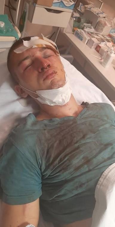 Majka brutalno pretučenog mladića iz Mostara: Moje dijete su pretukli, bacili u provaliju i urinirali po njemu