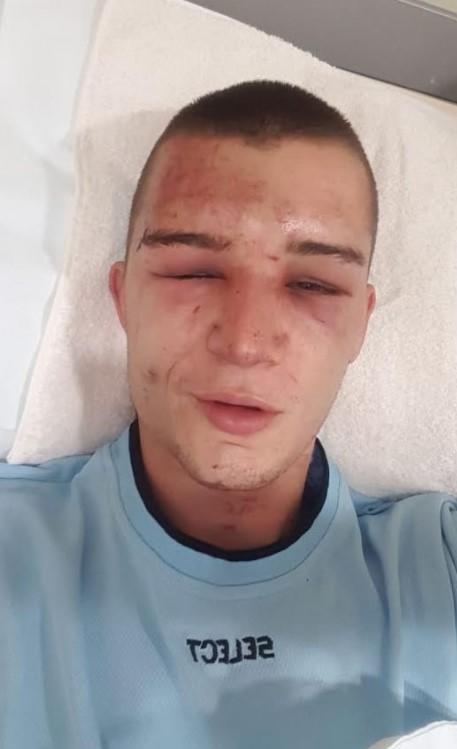 Brutalno pretučeni Eldin Buljina: Gledao sam smrti u oči, tukli su me dva sata i na kraju bacili u provaliju