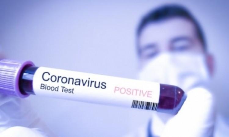 U Crnoj Gori 584 novozaraženih osoba od koronavirusa, petero preminulo
