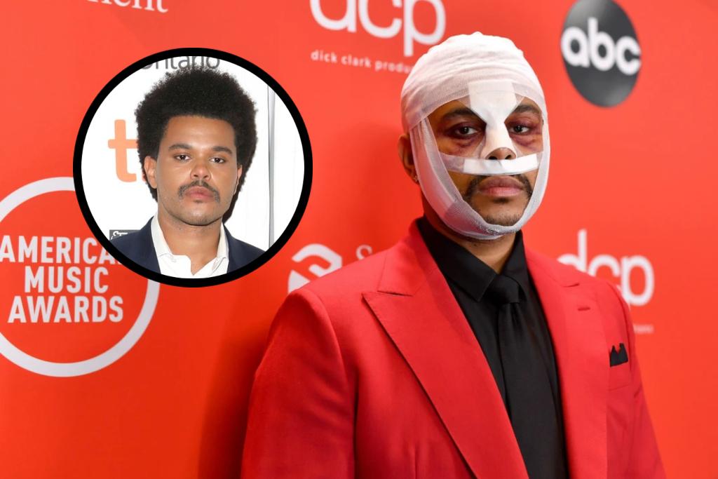 The Weeknd: Sumnjalo se da je operirao lice - Avaz