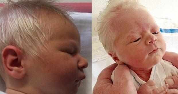 Beba rođena sa sijedom kosom - Avaz
