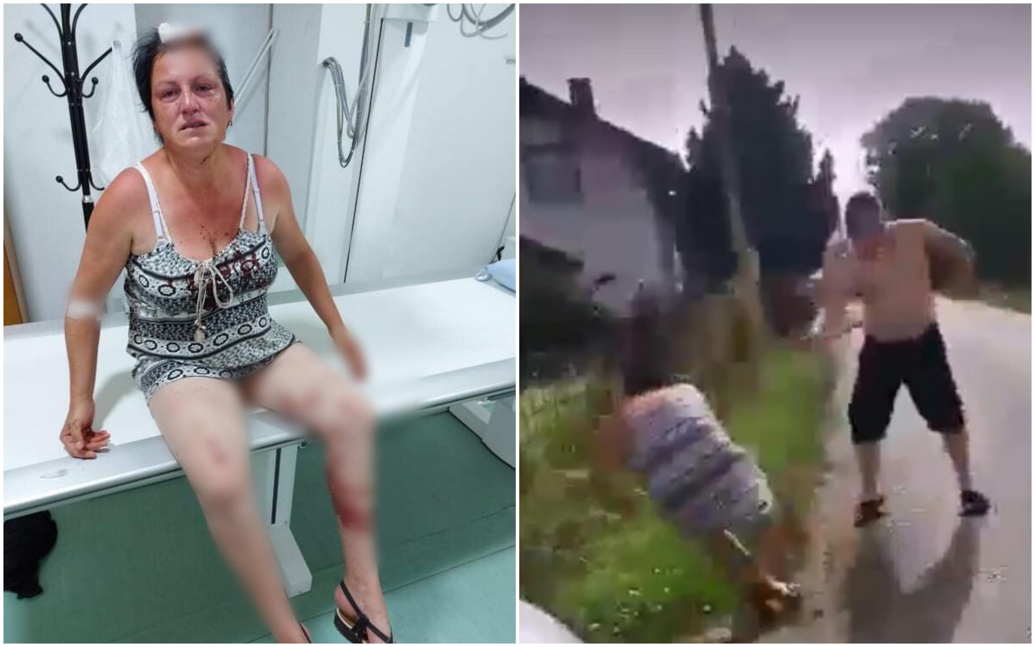 Užas kod Gračanice: Metalnom šipkom udarao ženu koja je branila kćerku, njenog supruga ganjao i u Hitnoj pomoći
