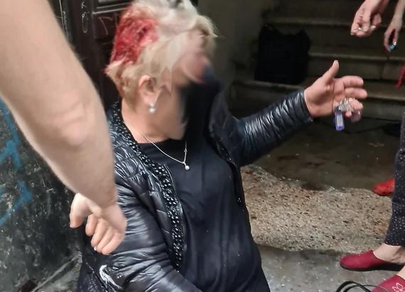 Uhapšena vlasnica dva rotvajlera koji su brutalno izgrizli ženu u centru Sarajeva