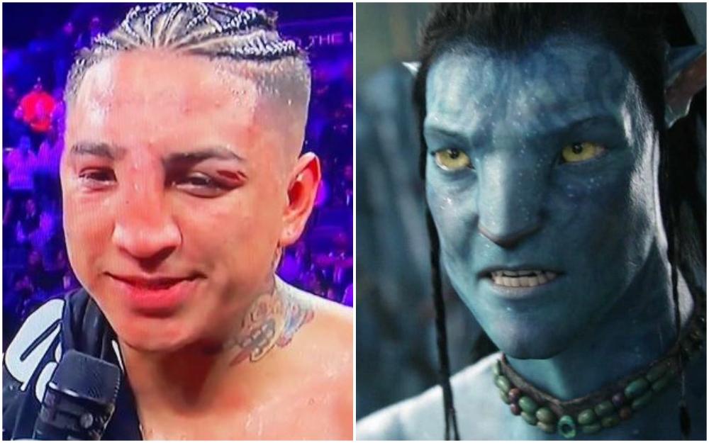 Bokseru deformisan nos nakon što je izdržao 12 rundi, zbog izgleda ga porede sa likom iz "Avatara"