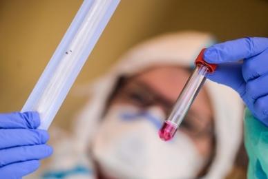 U Sveučilišnoj kliničkoj bolnici Mostar preminula jedna osoba od koronavirusa
