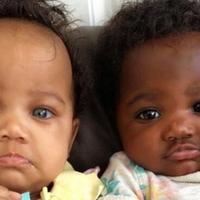Kako danas izgledaju blizanke s različitom bojom kože i očiju: Kao bebe bile su zvijezde Instagrama