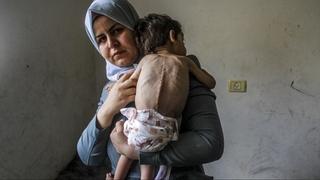 Vlada u Gazi: Oko 3.500 djece u opasnosti od smrti zbog pothranjenosti
