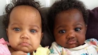 Kako danas izgledaju blizanke s različitom bojom kože i očiju: Kao bebe bile su zvijezde Instagrama
