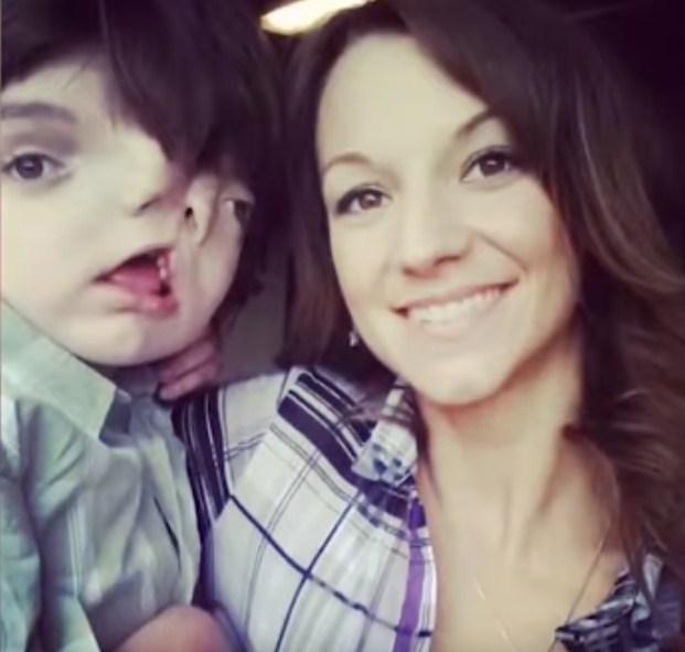 Svi su mislili da neće preživjeti | Dječak s dva lica proslavio 13. rođendan (VIDEO)