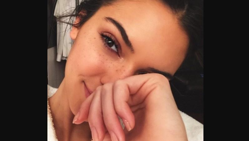 Dermatolog Kendall Jenner otkriva: Ove greške najčešće rade cure s aknama