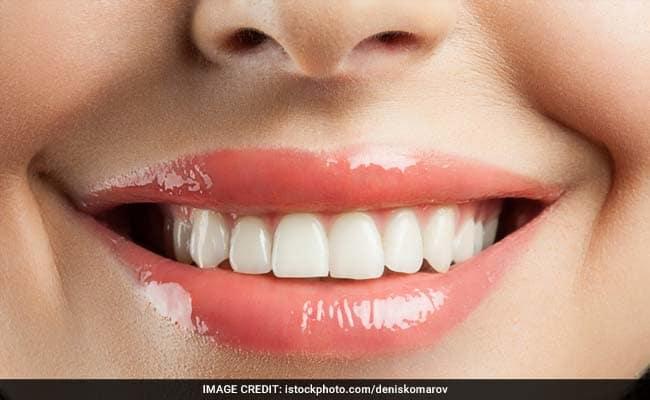 Postupak izbjeljivanja zuba u stomatološkoj ordinaciji traje otprilike sat - Avaz