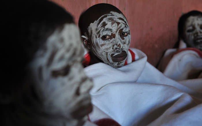 Tokom ritualnog obrezivanja u Africi umrlo više od 20 dječaka