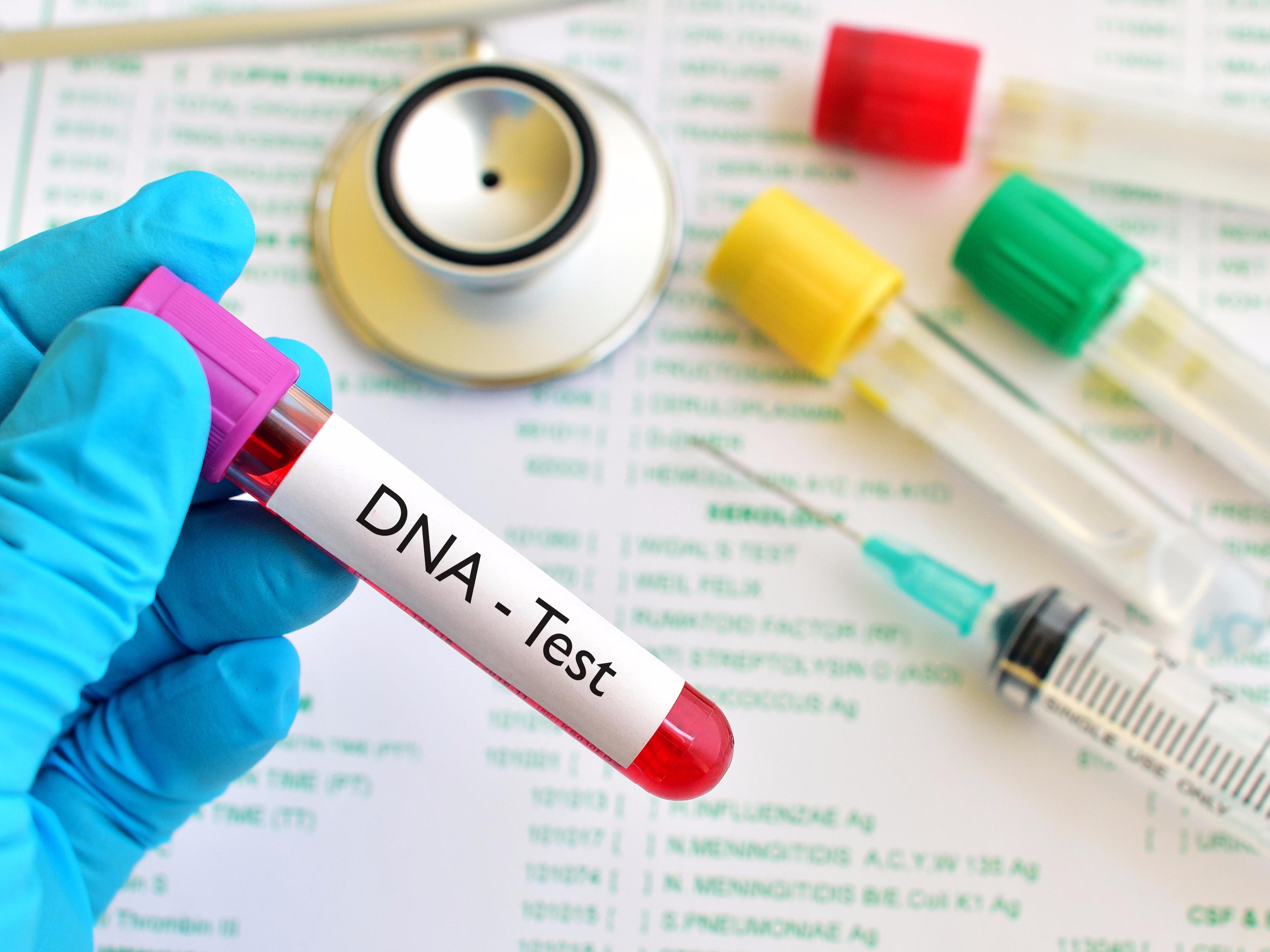 DNK testovi koje možete koristiti kod kuće sve su popularniji - Avaz