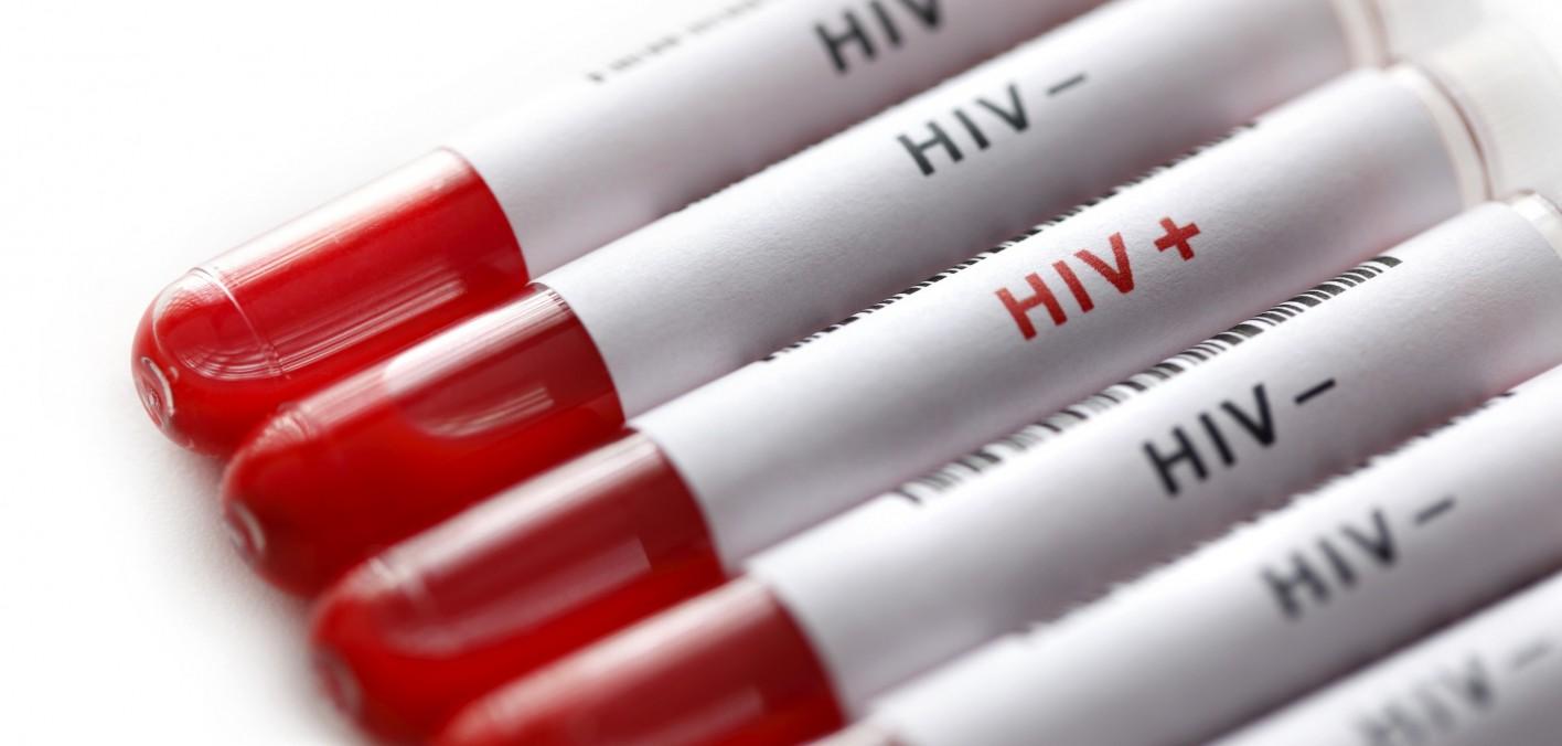 Uspješno testiranje antitijela za HIV