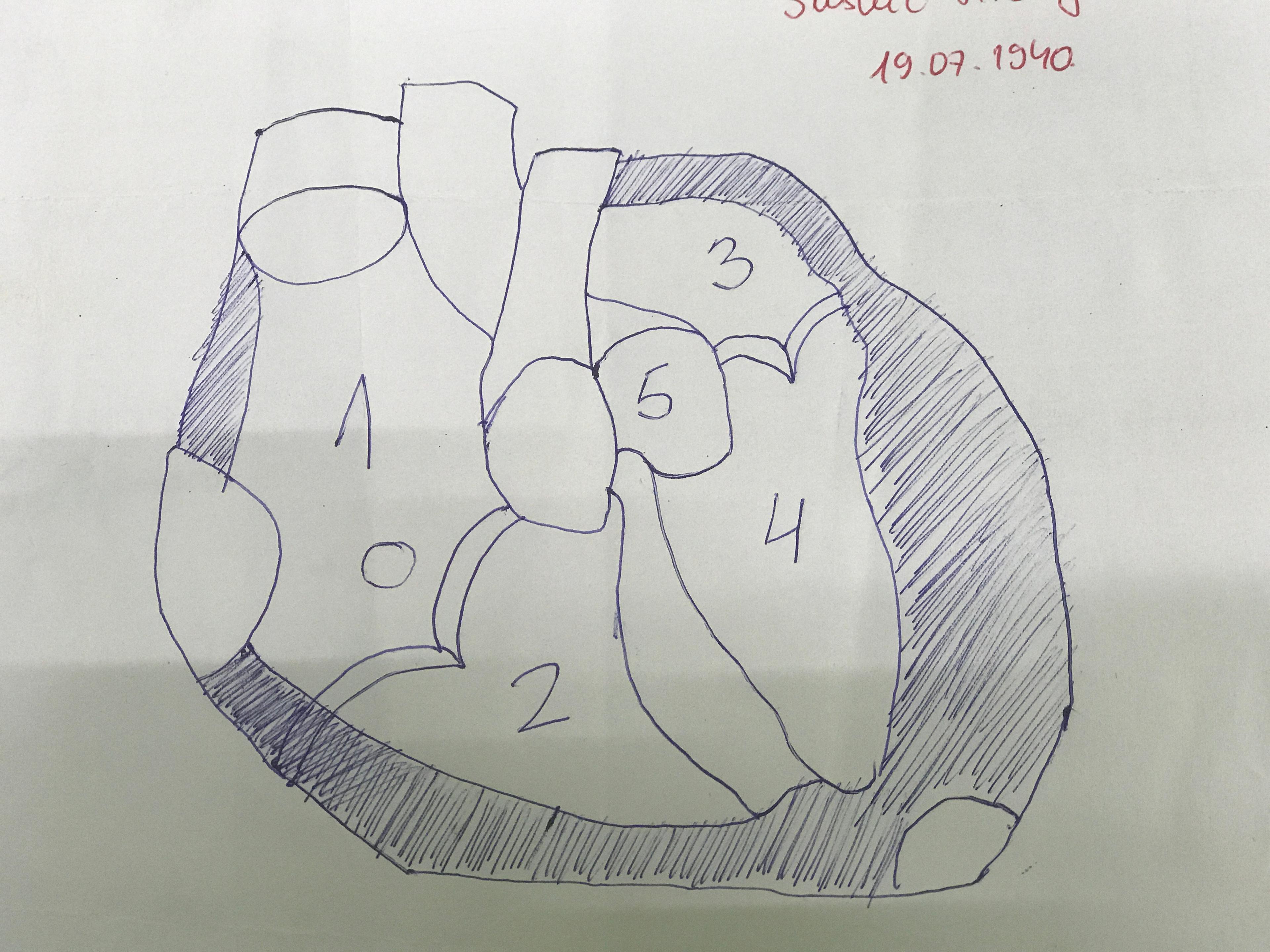 Crtež srca jednog od pacijenata - Avaz