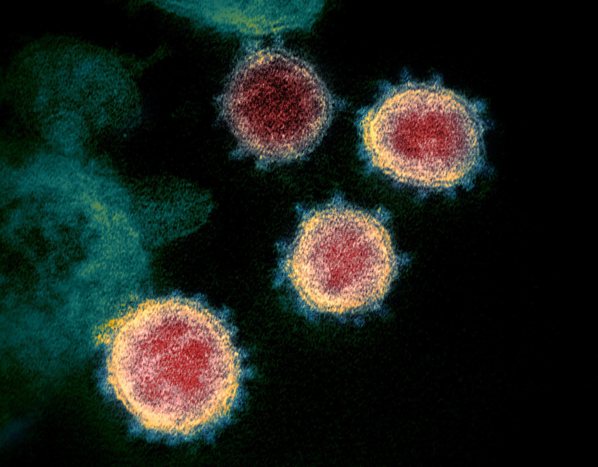 Koronavirus se može širiti i zrakom