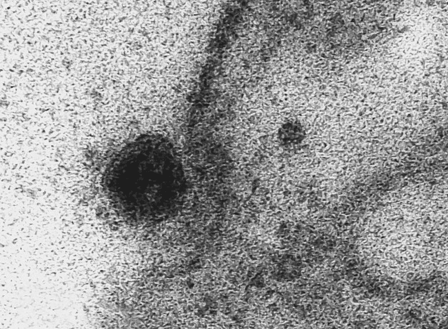 Virus napada ćeliju - Avaz
