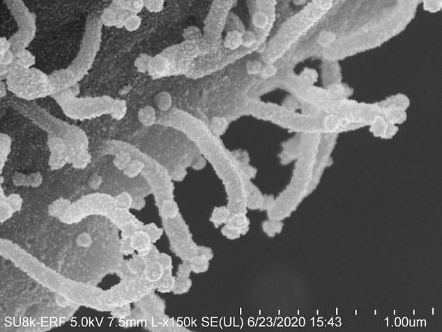 Na fotografijama pod mikroskopom se vidi kako zaražene ćelije razvijaju filopodije - Avaz