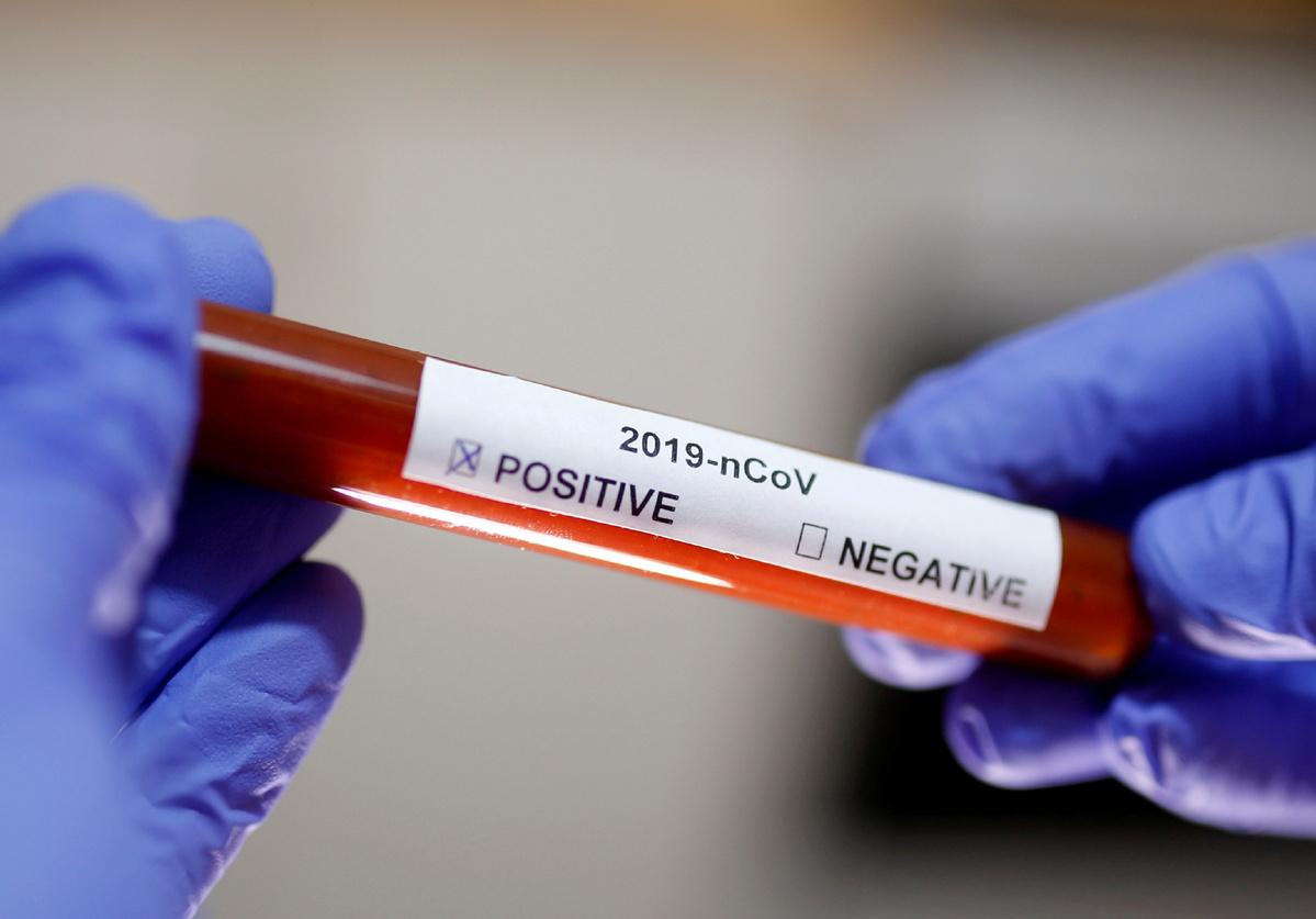 U Srbiji još 409 zaraženih koronavirusom, deset osoba preminulo