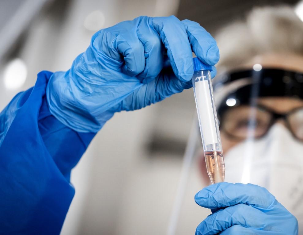 Serološko testiranje je laboratorijska pretraga kojim se utvrđuju antitijela na uzročnika određene infekcije iz uzorka krvi - Avaz