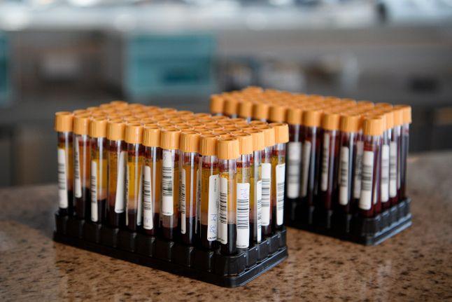 Hiljade Šveđana lažno pozitivno na koronavirus zbog kineskih testova - Avaz