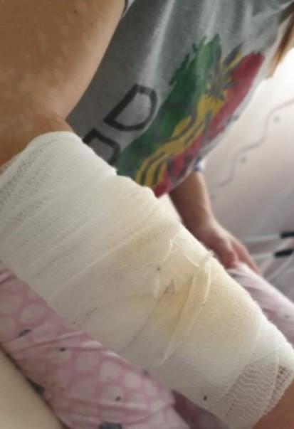 Migrant nožem povrijedio djevojku - Avaz