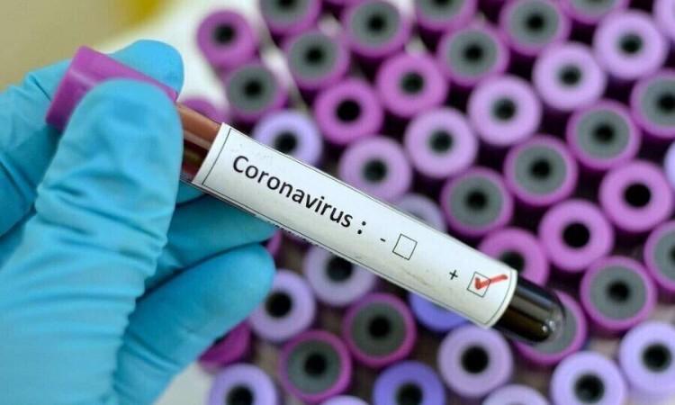 In the last 24 hours, 302 newly infected with coronavirus, 41 people died
