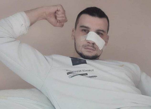 Ispovijest napadnutog Zeničanina za "Avaz": Senad Al-Hamdani je izletio s parkinga i zabio mi sječivo sjekire u glavu