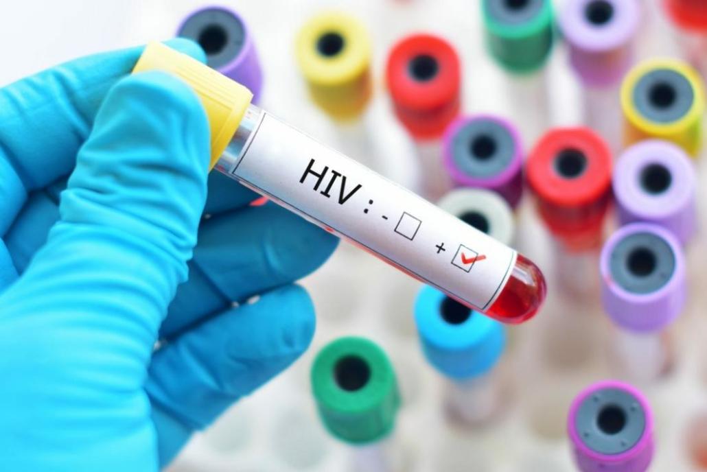 Zavod zdravstvenog osiguranja FBiH za "Avaz": Osiguran zamjenski lijek za liječenje zaraženih HIV-om