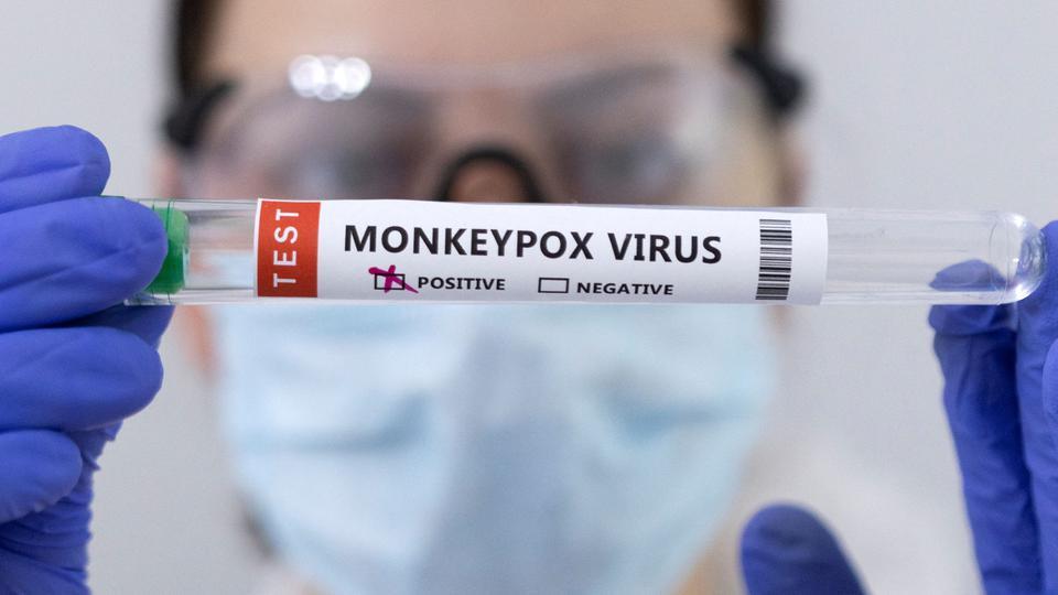 U Hrvatskoj 10 slučajeva majmunskih boginja, očekuje se dolazak vakcina