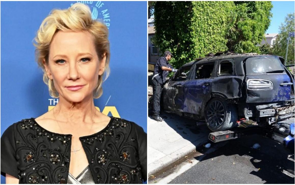 Holivudska glumica En Hek teško povrijeđena u saobraćajnoj nesreći: U kritičnom je stanju