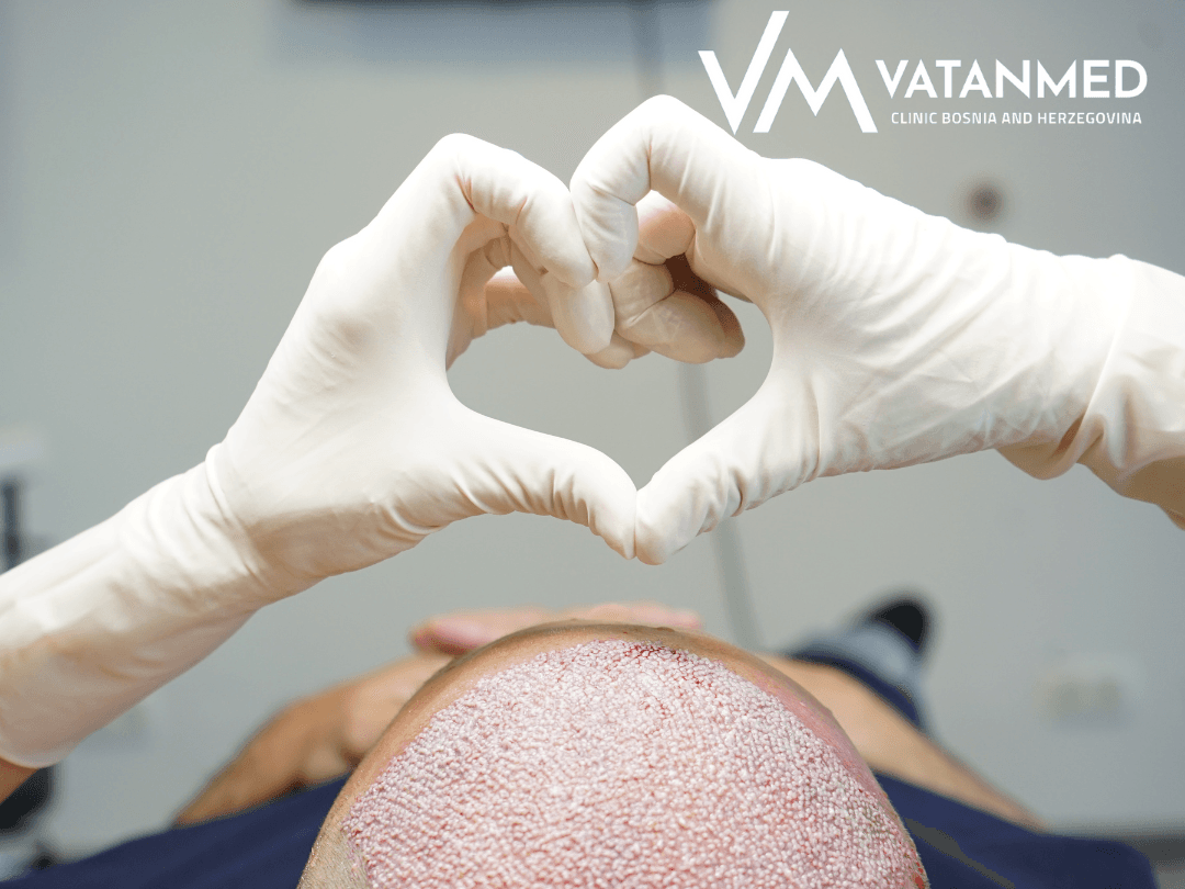 VatanMed najbolja klinika za transplantaciju kose na Balkanu - Ostvarite popust od 10 - Avaz